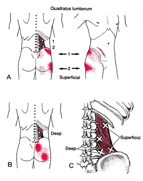 Myofasziale Triggerpunkttherapie